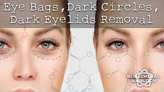 Remove Eye Bags Dark Circles Sunken Eyes and Dark Eye Lids Very Effective 100 [upl. by Neelik152]