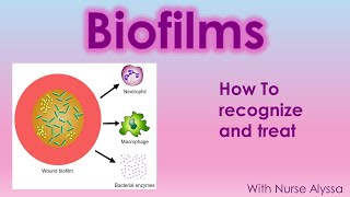 Biofilms  How to recognize and treat [upl. by Falk]