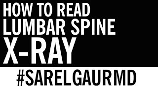 How to Read Lumbar Spine XRay  Anatomy [upl. by Rehpotsirahc]