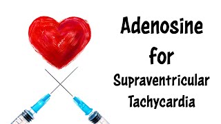 Adenosine for Supraventricular Tachycardia SVT A Basic Tutorial [upl. by Nuahsed]