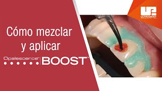 Cómo mezclar y aplicar el blanqueamiento dental médico Opalescence™ Boost™ [upl. by Dolley]