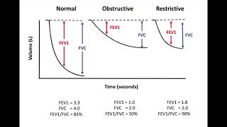 Obstructive vs Restrictive Lung Disorders SPEEDRUN [upl. by Notyal]