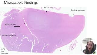 Neuropathology  Part 1 [upl. by Nuawad]