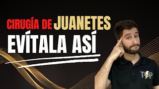 EL TRATAMIENTO Y MANEJOS SIN CIRUGÍA DEL JUANETE [upl. by Ahsain773]