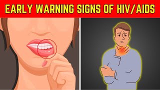 Identify The Early Signs Of HIV AIDS  10 Signs Of HIV Positive [upl. by Kohl]