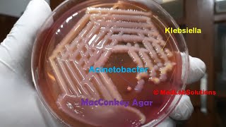 Acinetobacter and Klebsiella Growth on Macconkey agar Demonstration [upl. by Okomot231]