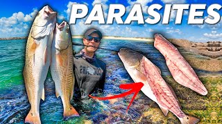 We Are All Eating Parasites What You Need to Know Jetty Fishing [upl. by Aklam]