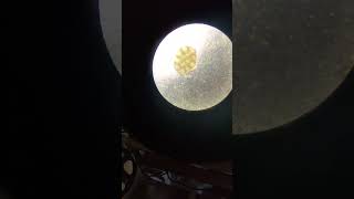 Tapeworm egg in dogs Dipylidium caninum pt2 parasite dogs tapeworm [upl. by Karlen]