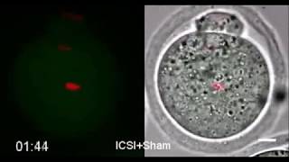 Single nucleolus precursor body formation in the pronucleus of mouse zygotes and SCNT embryos [upl. by Hedda]