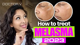 HOW TO TREAT MELASMA [upl. by Grimes]