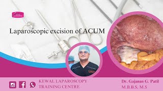 Laparoscopic excision of ACUM Kewal Hospital  Laparoscopy Training [upl. by Romola]