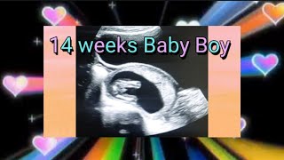 14 weeks baby boy 🔷️ ultrasound  14 weeks fetus  pregnancy usg  How to tell gender on ultrasound [upl. by Lledor]