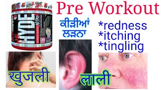 Pre Workout Itching  Pre Workout से खुजली Pre Workout Side Effects  Control Itching Of PreWorkout [upl. by Wilburn]