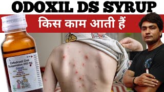 odoxil ds 250 mg syrup uses in hindi  odoxil ds 250 mg syrup uses in hindi  odoxil ds syrup [upl. by Greenwood966]