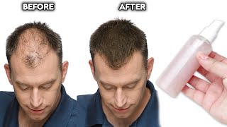 2 Natural Methods to Increase Thickness and Volume of Your Hair I Hair Growth tips [upl. by Jd]