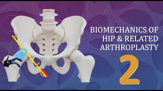 Hip Joint Biomechanics and arthroplasty Simplified Basics Part 2 of 3 [upl. by Dyer]