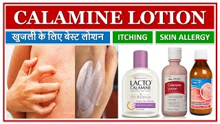 CALAMINE LOTION खुजली के लिए बेस्ट लोशन ITCHING SKIN ALLERGY INSECT BITES ECZEMA SKIN LOTION [upl. by Tnarg]