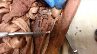 Cat Dissection Urinary System Final [upl. by Ydarg]