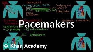 Pacemakers  Circulatory System and Disease  NCLEXRN  Khan Academy [upl. by Eido]