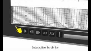 hmtPlayer™  Fetal Heart Monitor Tracing  Animated [upl. by Nedarb]