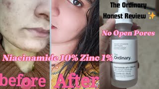 The Ordinary Niacinamide 10  Zinc 1  How to use The Ordinary Niacinamide  Zinc serum [upl. by Verlee]