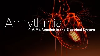 Heart Arrhythmia – Yale Medicine Explains [upl. by Averat661]