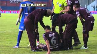 Braghieri se retiró lesionado Tigre 0  Lanús 1 Fecha 13 Primera División 2016 [upl. by Weathers]