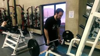 135lb Deadlift Ugly Left Below Knee Amputee [upl. by Ferdinand]