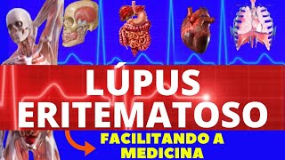 LÚPUS ERITEMATOSO  O QUE É CAUSAS E SINTOMAS  TUDO SOBRE LÚPUS ERITEMATOSO  REUMATOLOGIA [upl. by Zicarelli]