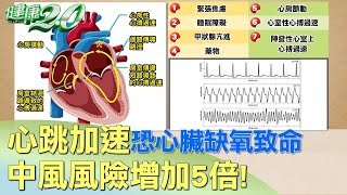 心跳加速恐心臟缺氧致命 中風風險增加5倍！ 健康20 [upl. by Aikkin]