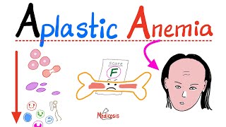 Aplastic Anemia  All you need to know  Definition Causes Symptoms Diagnosis amp Treatment [upl. by Ellehcer]