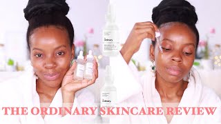 The Ordinary Skincare Review  Niacinamide 10 Zinc 1 and Alpha Arbutin 2  HAacne prone skin WOC [upl. by Tonry]