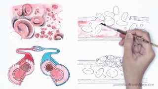 Platelet Rich Plasma PRP  A short Introduction [upl. by Marie-Jeanne426]