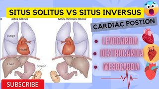 Situs Solitus vs Situs Inversus position of Heart  Levocardia  Dextrocardia  Mesocardia in Urdu [upl. by Bolling759]