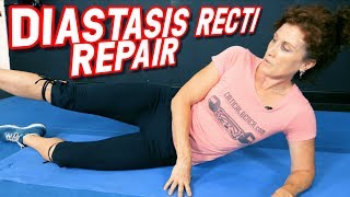 Top 5 Exercises to REPAIR Diastasis Recti [upl. by Ecnirp]