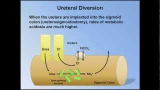 Normal Anion Gap Metabolic Acidosis ABG Interpretation  Lesson 9 [upl. by Rawlinson]