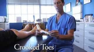 Spread Your Toes™ Series Crooked amp Overlapping Toes Conservative Care vs Conventional Care [upl. by Tarrance703]