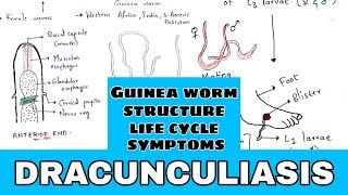 Dracunculiasis  Guinea worm  Structure Life cycle symptoms treatment  Bio science [upl. by Fenton492]