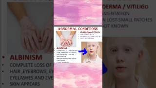 Albinismskinclass9th icseexam9thbio [upl. by Arbe744]