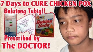 BULUTONG TUBIG  CHICKEN POX TREATMENTprescribed by the Doctor [upl. by Ailegna907]