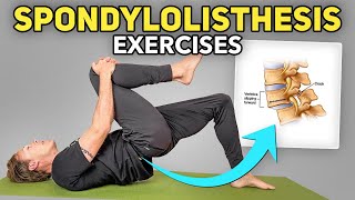 5 Exercises for Lumbar Spondylolisthesis [upl. by Butterfield]