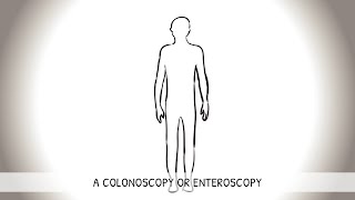 Koloskopie Innere Medizin [upl. by Akemor]