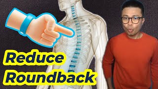 Thoracic Roundback Fix it with Manual Therapy amp Exercises [upl. by Marlon568]