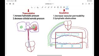 Pleural Effusion Causes investigationTreatment [upl. by Trahurn607]