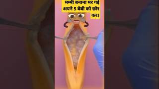 Apnea 5 baby ko chor kar mar gie mummy bananafruitsurgery fruithospital viralvideo [upl. by Judon]