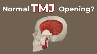 Health VS Click VS Limited Opening Series Part 1 Healthy TMJ [upl. by Gord184]