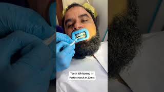 orthodonticbraces duet dentistteeth teethbraces dentistry teethwhitening 🦷🦷 [upl. by Kazim762]