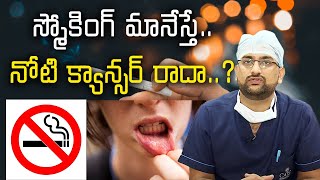 Symptoms and Treatment for Mouth Cancer స్మోకింగ్‌ మానేస్తే నోటి క్యాన్సర్‌ రాదాSamayam Telugu [upl. by Atnomed663]