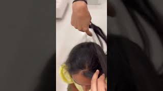 Frontal Hair Thinning Coverage With Small Hair Patch  Hair Extensions India 1hairstop shorts [upl. by Nus579]