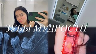 Я УДАЛИЛА 3 ЗУБА  боль страх и стоимость  почему они такие большие  🦷💉 [upl. by Atalante]